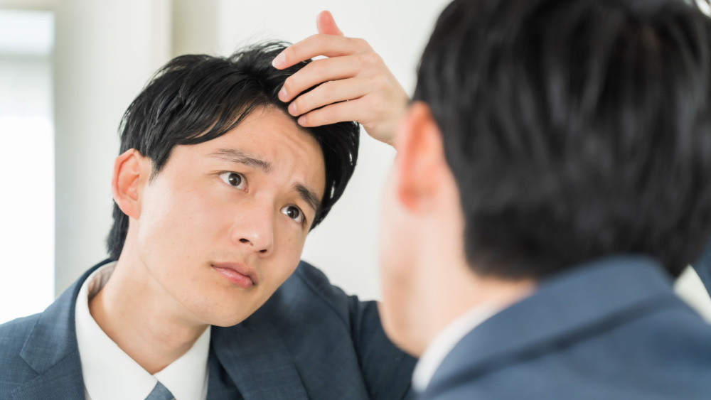 別再迷信偏方! 男性「狂落髮」還有得救嗎? 研究:每週喝6杯「這飲料」恐傷害毛囊