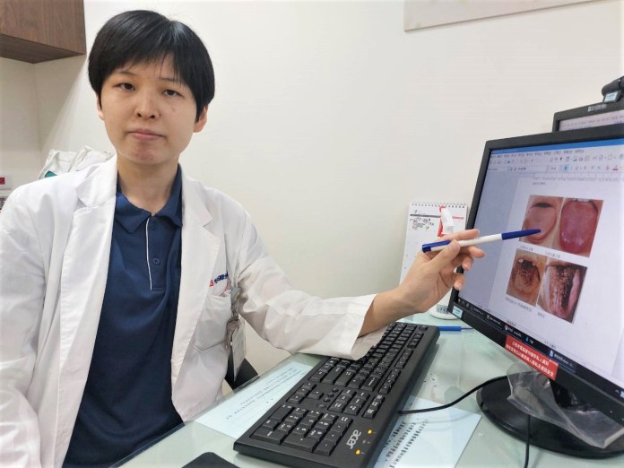 4歲男童口服10天抗生素 口腔赫見「黑毛舌」嚇壞媽媽 79 | 健康 記者爆料網