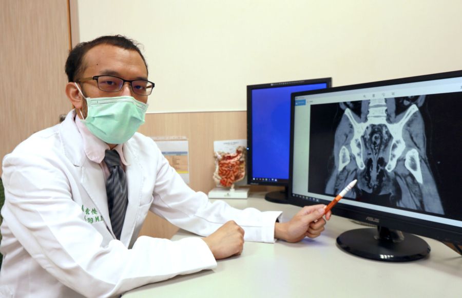 男子嚴重便秘「硬摳菊花」 2天後肛門發痛!醫師一看死亡率高達9成 200 男子嚴重便秘「硬摳菊花」 2天後肛門發痛!醫師一看死亡率高達9成 199