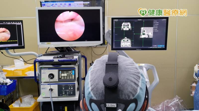「鼻竇炎合併鼻息肉」致鼻塞、嗅覺低下! 「生物製劑」精準醫療解患