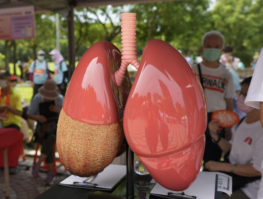 比癌症還凶!熟男咳、喘不當一回事 確診「菜瓜布肺」不到一年就沒命 206 比癌症還凶!熟男咳、喘不當一回事 確診「菜瓜布肺」不到一年就沒命 205