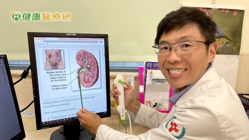 「吸石雙嬌」軟式輸尿管鏡手術 一次解決腎結石困擾