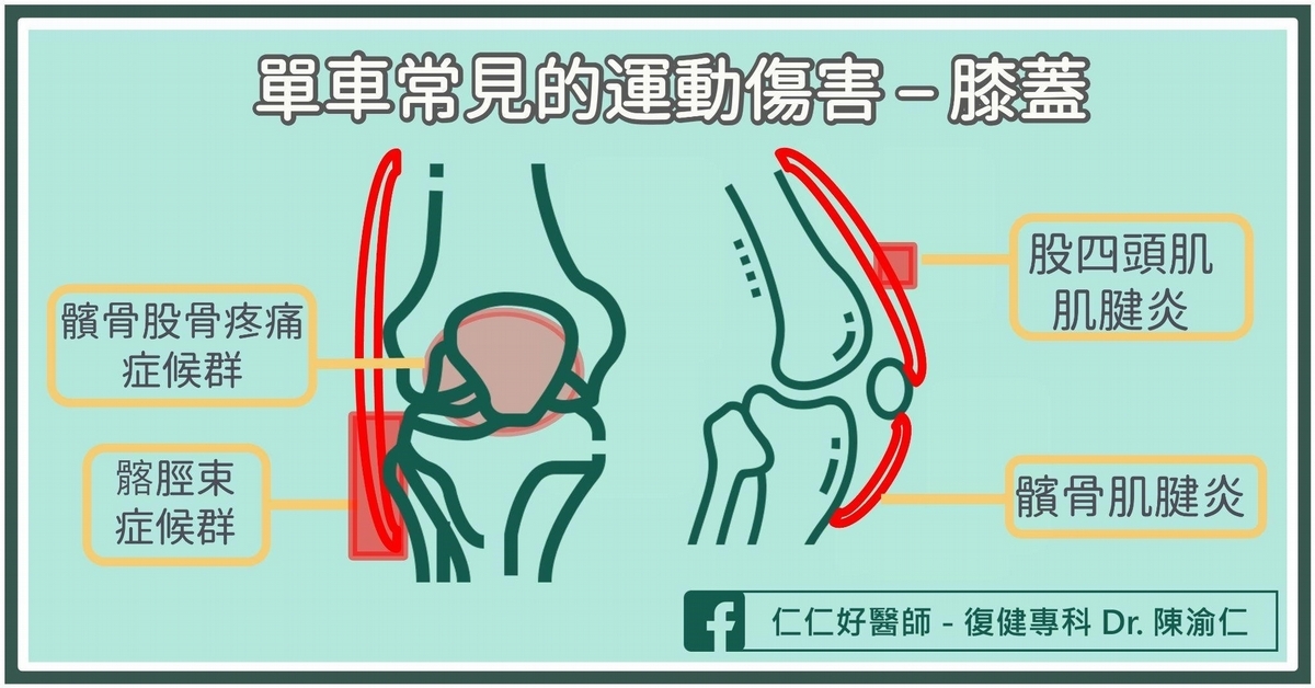 單車運動傷害1:膝蓋