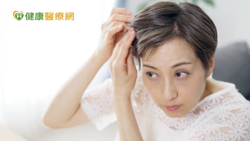 髮片遮不住! 事業女強人掉髮求助中醫改善