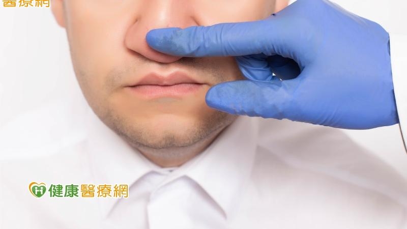 車禍撞擊、球K到導致鼻子變形有救嗎？　醫師QA一次看
