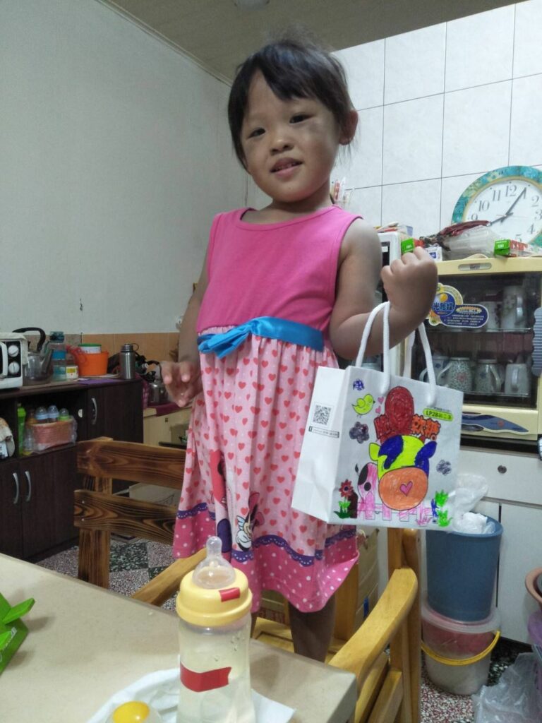 小真出生從小腿以上都是紫青色胎記
