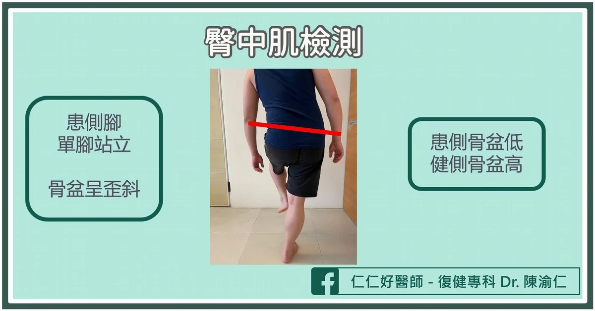 臀中肌受傷有什麼症狀?