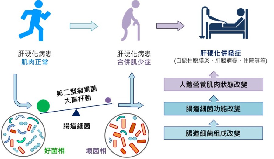 肝硬化病人發生肌少症怪「它」？ 北榮研究揪出三腸道細菌 247