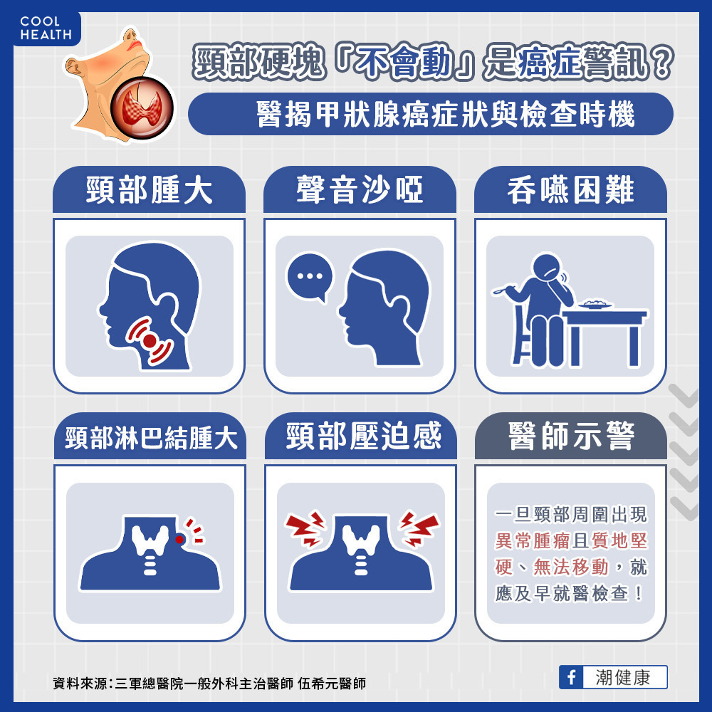 當心頸部硬塊「不會動」! 甲狀腺癌症狀與檢查時機 當心頸部硬塊「不會動」! 甲狀腺癌症狀與檢查時機