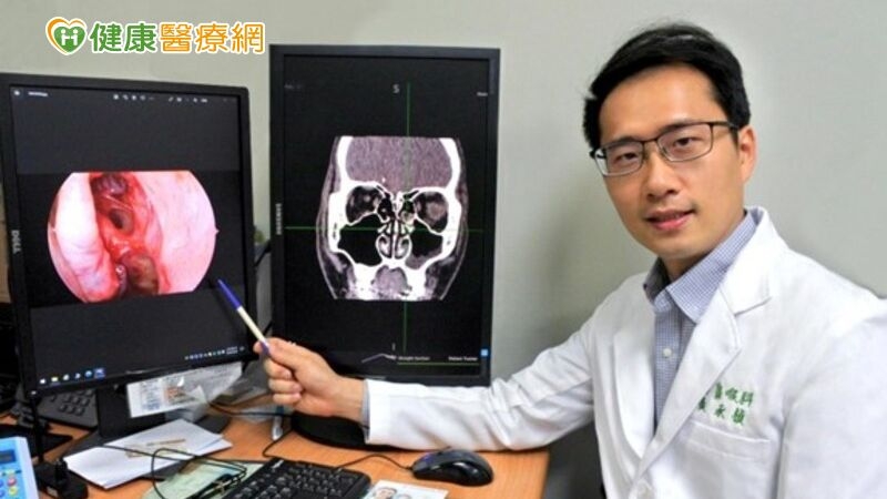 慢性鼻竇炎治療新科技 膠原蛋白基質粉輔助傷口癒合