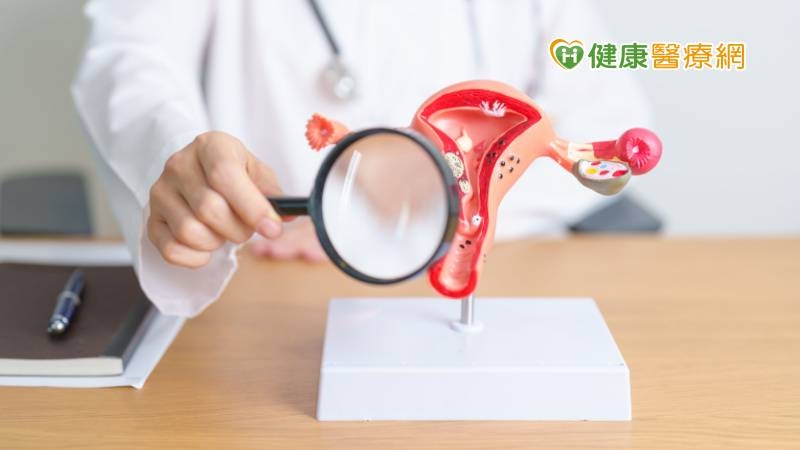 子宮肌瘤治療新選擇 「海芙刀」免開刀保留子宮完整性