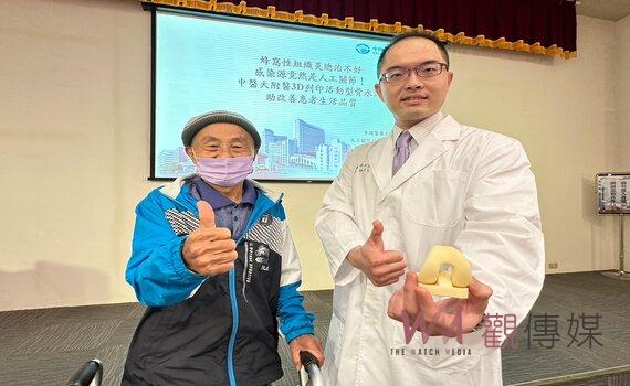 人工關節染蜂窩性組織炎 植入「3D列印活動型骨水泥」術後行走自如