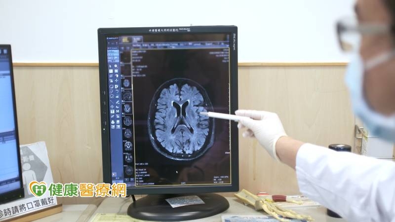 精明老翁變的溝通困難 AI僅1分鐘就揪出腦齡比實際老5歲!