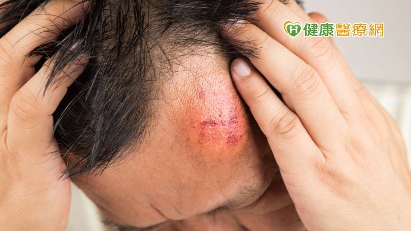 50歲男頭部莫名腫脹滲出膿血,竟是惡性骨肉瘤! 醫:2年齡易發生