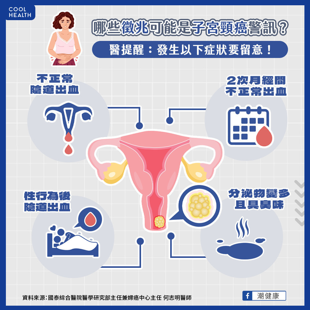 子宮頸癌可能發生的徵兆 子宮頸癌可能發生的徵兆