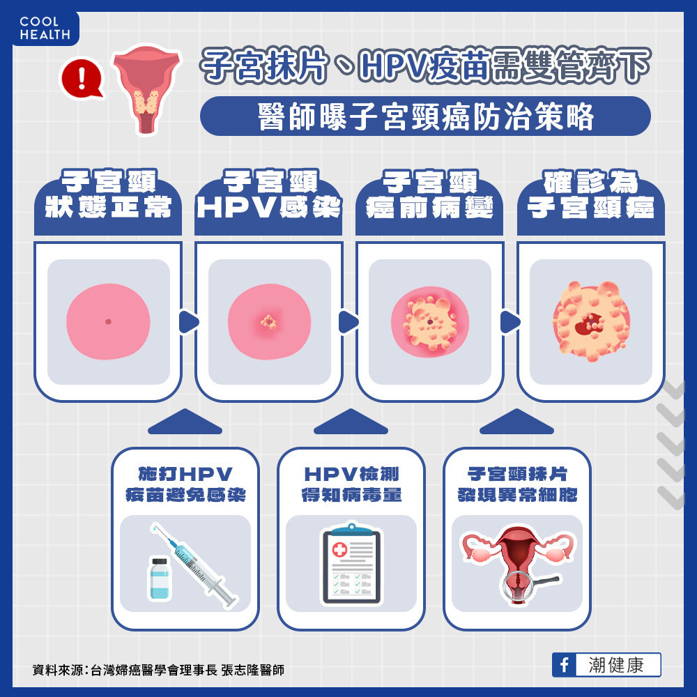 預防HPV就能防99%子宮頸癌! 醫建議子宮抹片、HPV疫苗「雙管齊下」 預防HPV就能防99%子宮頸癌! 醫建議子宮抹片、HPV疫苗「雙管齊下」