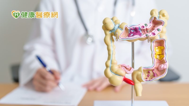 大腸癌篩檢陽性應再篩一次?二次篩檢陰性就沒事? 錯!「這樣做」才正確