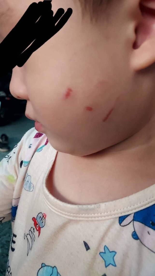 漾新聞|高市公幼爆疑似霸凌幼兒事件 家長指証歷歷老師前後說法反覆