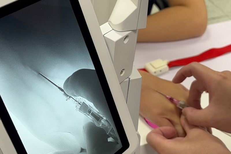 透過顯影的技術進行靜脈定位。圖/台中市政府消防局