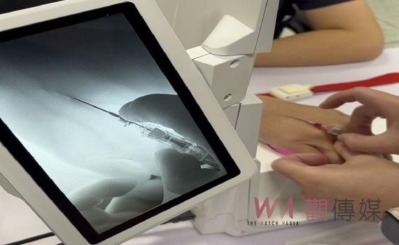 提升靜脈注射成功率!中市消防中級救護技術員體驗「3D靜脈定位儀」