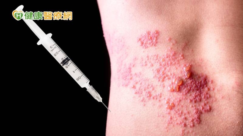 秋冬「皮蛇」蠢蠢欲動! 醫警告「這些罹病高風險人」快打疫苗
