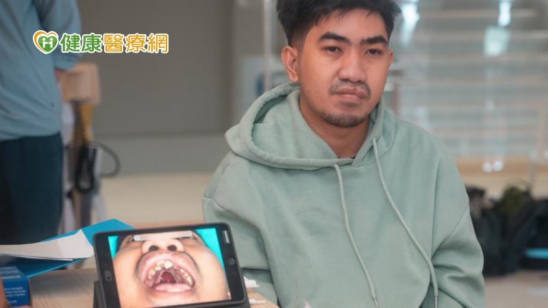 台灣義診團至菲律賓為顱顏缺陷患者診治 27歲男修復腭裂食物不再從鼻流出