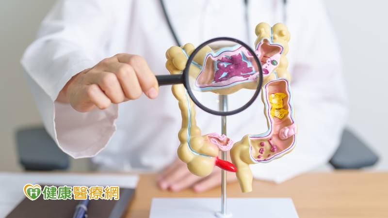 我沒症狀怎麼有腸癌?一定要做造口嗎? 專家Q&A破解迷思