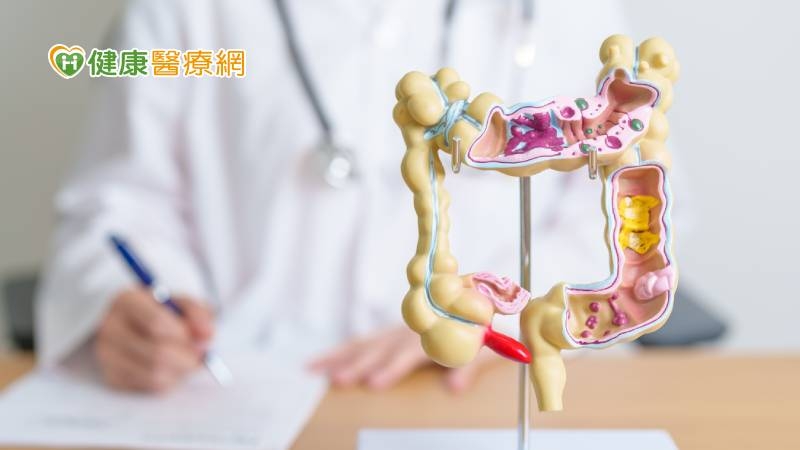 近9成大腸癌發生於「這年齡」! 篩檢陽性未做大腸鏡檢風險最高增64%