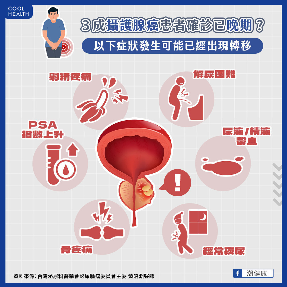台灣攝護腺癌確診晚期 高出歐美國家近3倍 台灣攝護腺癌確診晚期 高出歐美國家近3倍