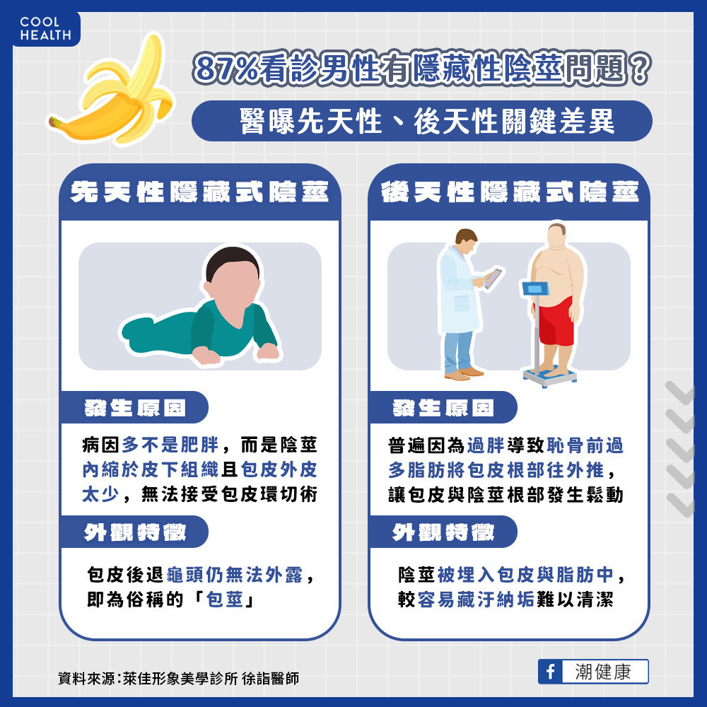 天冷下面縮短看不到? 87%看診男性有隱藏性陰莖問題 天冷下面縮短看不到? 87%看診男性有隱藏性陰莖問題