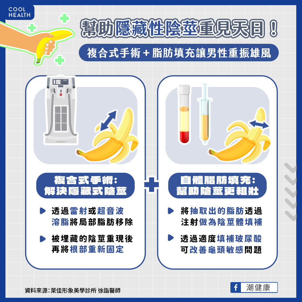 減重搭配複合式治療 幫助隱藏性陰莖重見天日 減重搭配複合式治療 幫助隱藏性陰莖重見天日