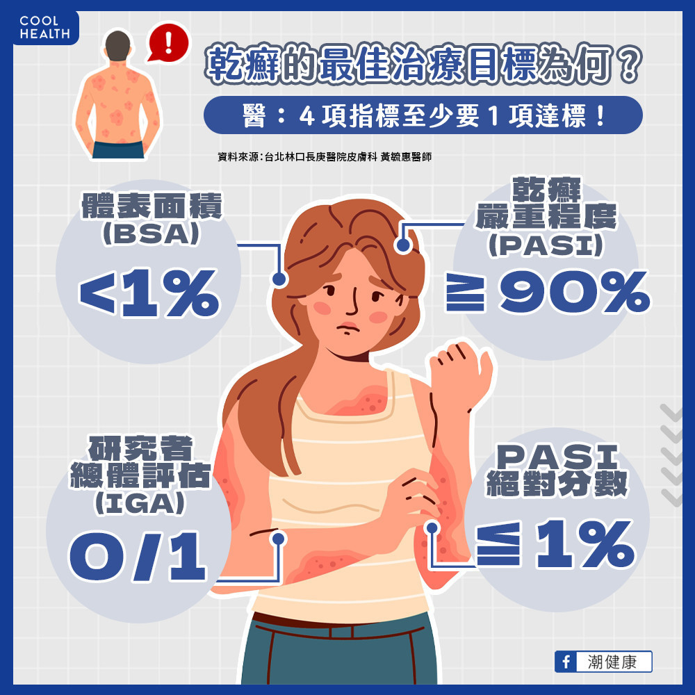 天冷乾癬病灶大爆發? 醫:及早達到最佳治療目標 天冷乾癬病灶大爆發? 醫:及早達到最佳治療目標