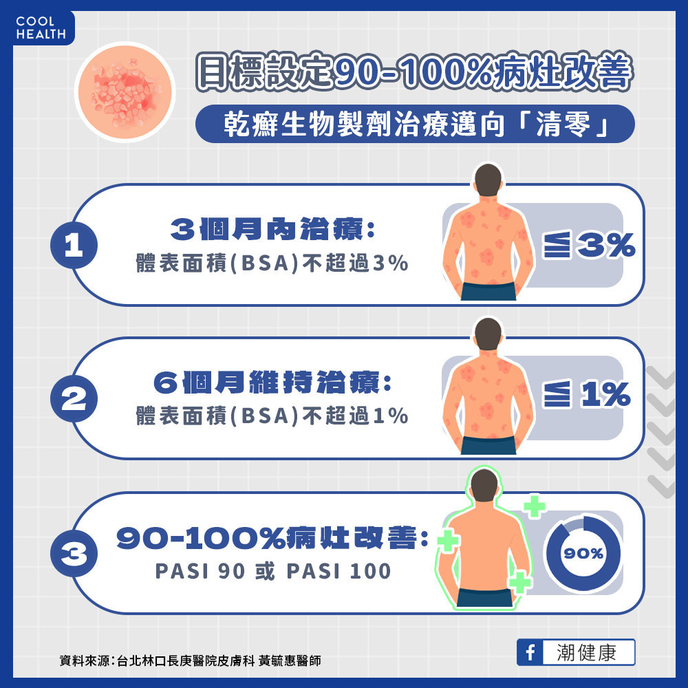 中重度乾癬治療困境? 生物製劑助攻朝「清零」前進 中重度乾癬治療困境? 生物製劑助攻朝「清零」前進