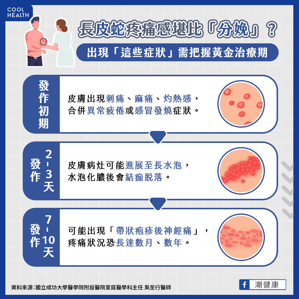 打嗎啡也無法完全緩解? 「帶狀疱疹後神經痛」恐比分娩還痛 打嗎啡也無法完全緩解? 「帶狀疱疹後神經痛」恐比分娩還痛