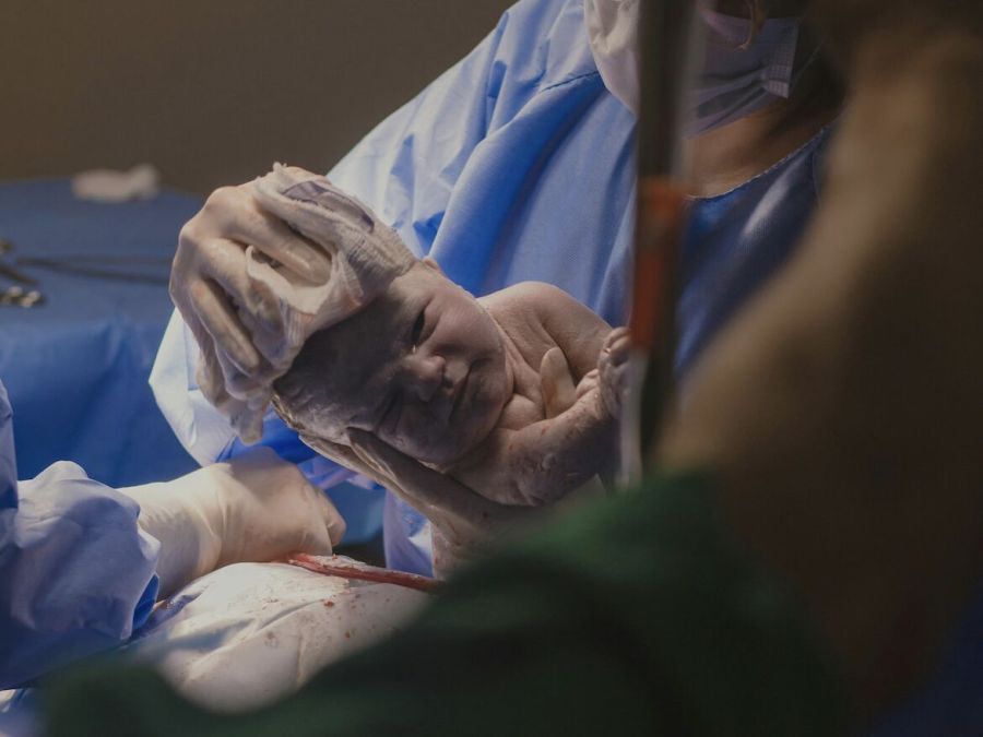 台灣剖腹產越來越多 隱憂?罕見「疤痕子宮內膜異位症」變多了 230 台灣剖腹產越來越多 隱憂?罕見「疤痕子宮內膜異位症」變多了 229