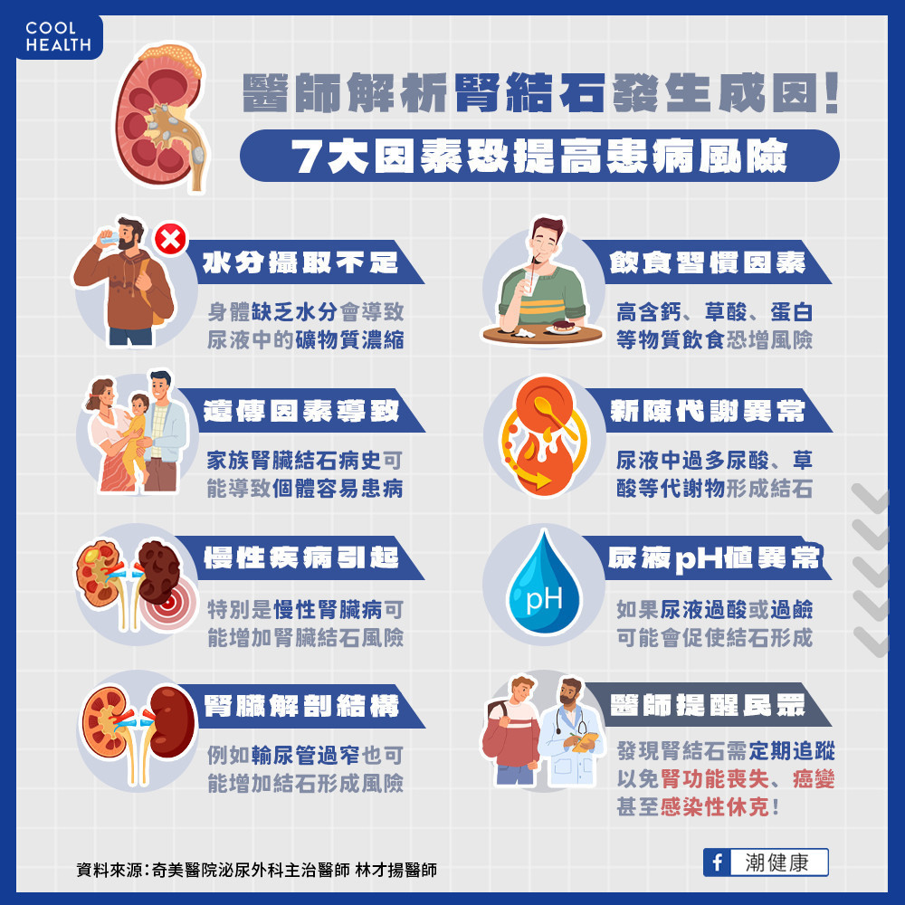 解析腎結石發生成因!「7大因素」恐提高患病風險 解析腎結石發生成因!「7大因素」恐提高患病風險