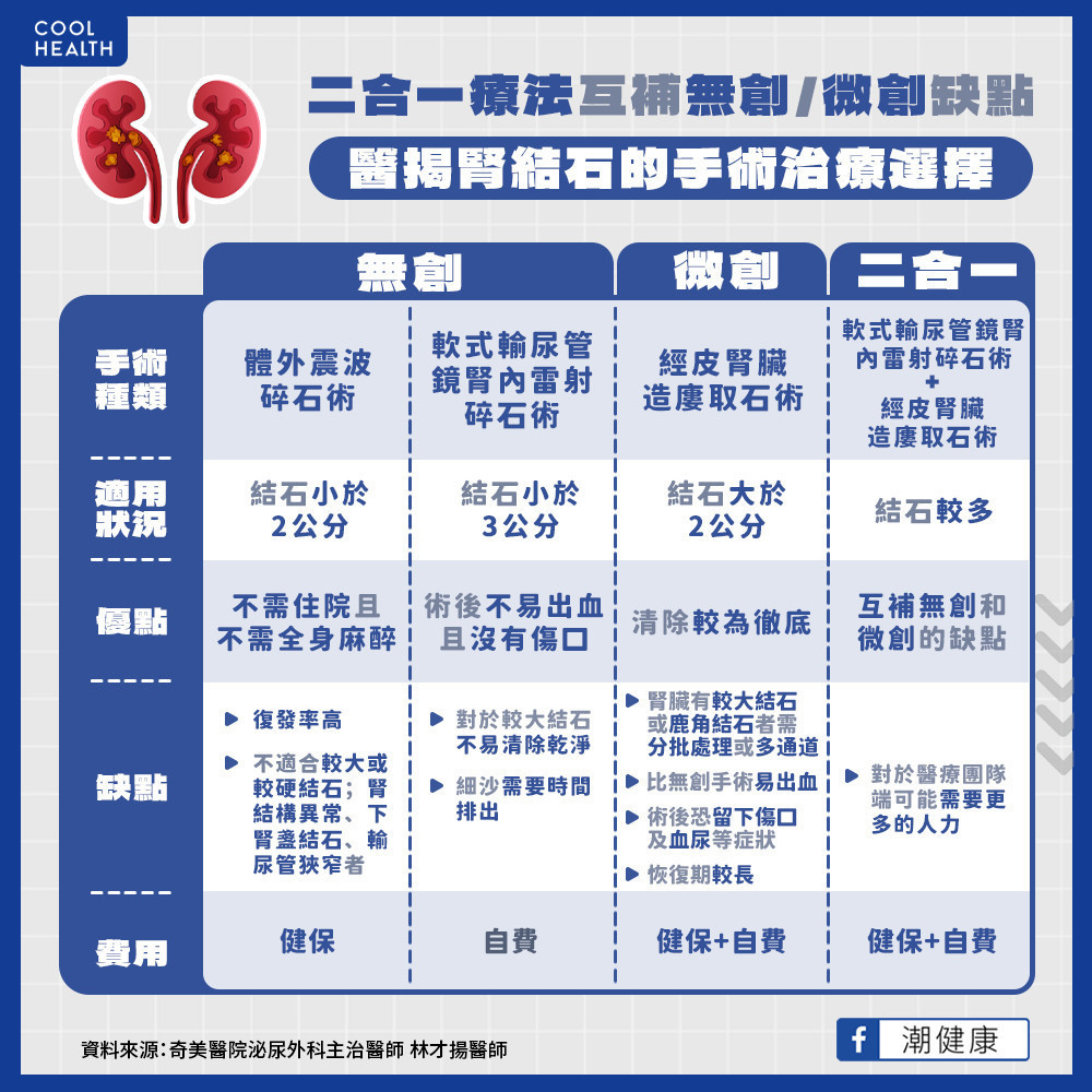 腎結石手術治療多元 個人化方法為病人除去頑石 腎結石手術治療多元 個人化方法為病人除去頑石