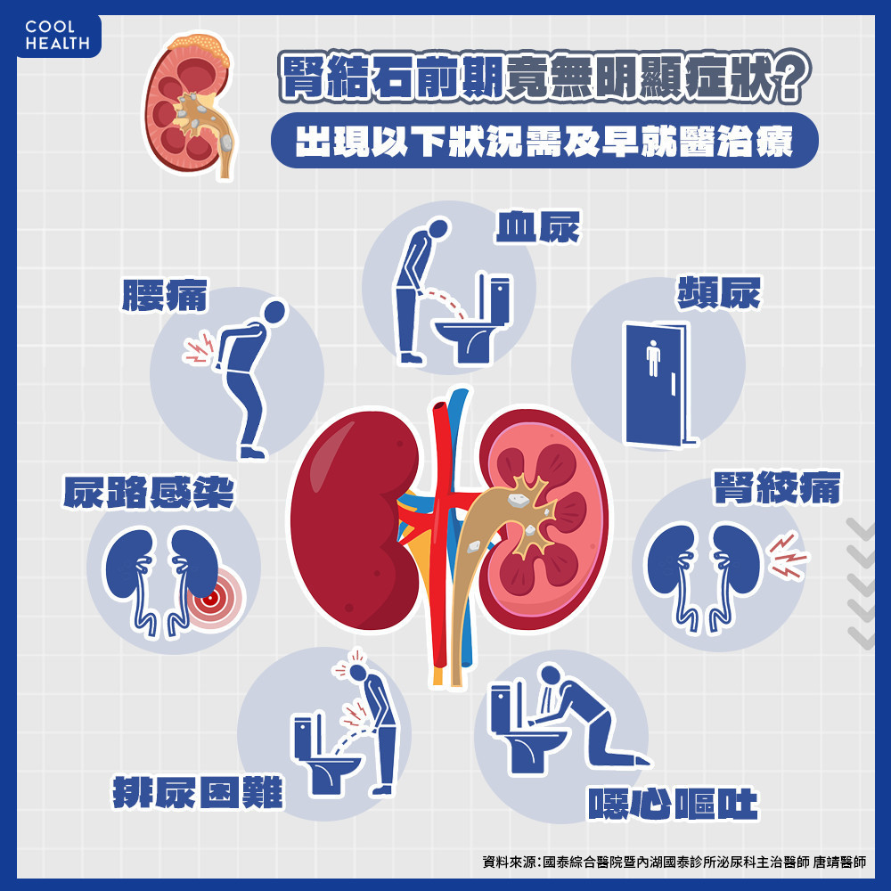 泌尿道結石未必有症狀 恐引發慢性感染影響腎功能 泌尿道結石未必有症狀 恐引發慢性感染影響腎功能
