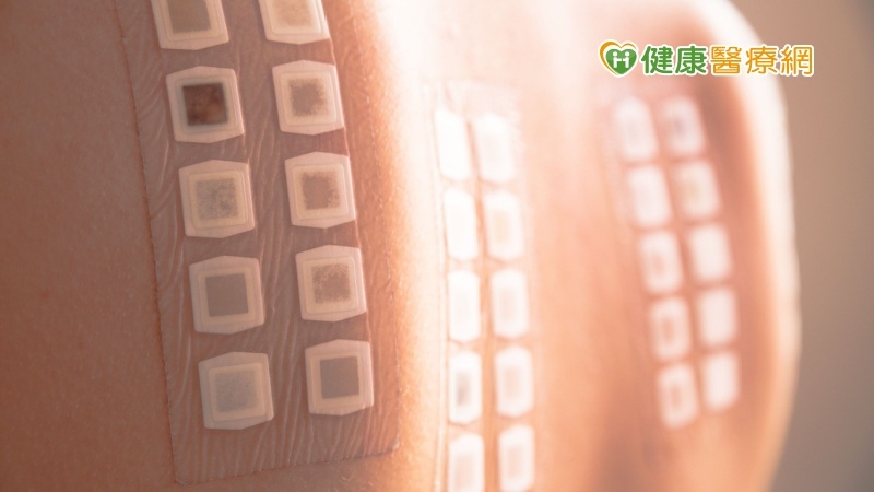 氣溫急降,鼻水狂流! 中醫「三伏貼療法」改善50%症狀
