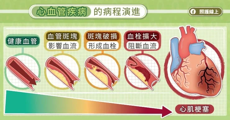 心血管疾病，高危險群要當心