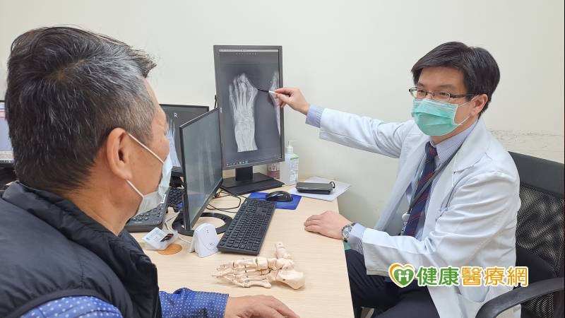 拇趾外翻又痛又醜長達10年 手術治療後登山健步如飛