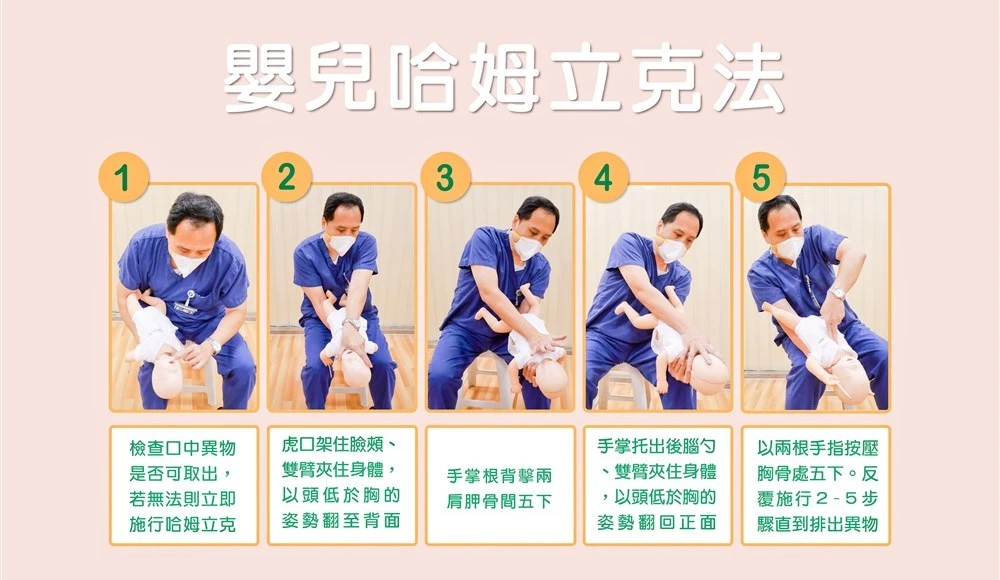 莊浩凌醫師示範嬰兒哈姆立克法步驟,重點是「頭下腳上」。