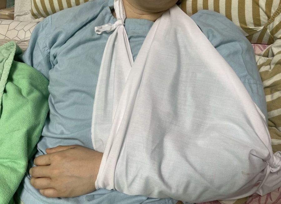 肩膀動手術「不動最好」？ 顛覆醫界！長庚研究：術後第一天就復健好更快 211