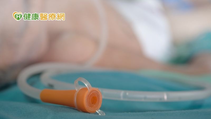 臨終還要再插鼻胃管嗎?研究:插管到去世僅約10天 短時間內受「這些」苦