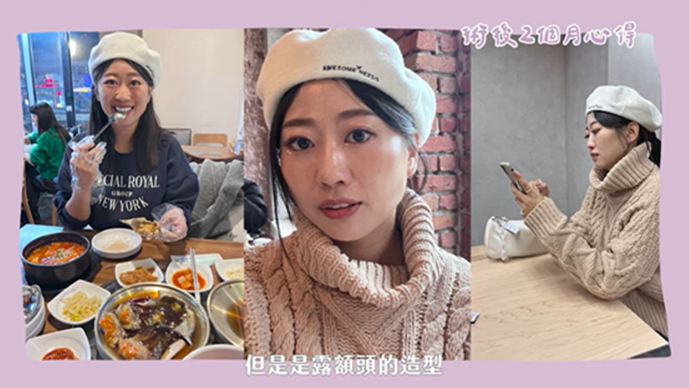 冰蹦拉施打一個月後就發現嘴邊肉減少,輪廓線明顯緊緻許多 冰蹦拉施打一個月後就發現嘴邊肉減少,輪廓線明顯緊緻許多