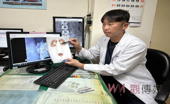體內頑石反覆作怪痛不欲生!光田綜合醫院:軟式輸尿管鏡手術揪出凶手