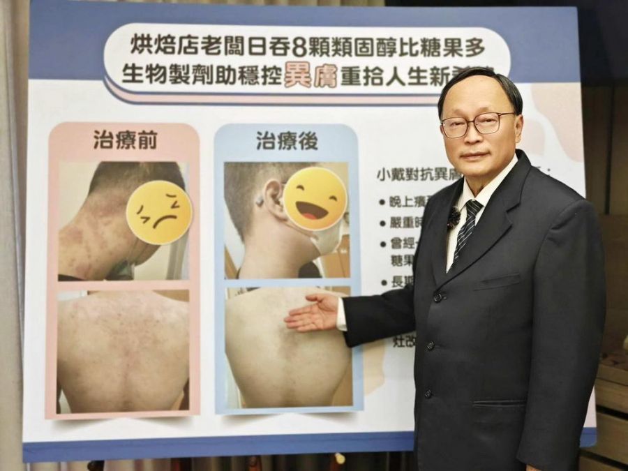 大林慈濟妙手仁醫賴寧生 助異膚患者重拾人生