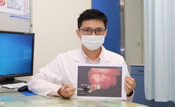 6旬婦長期貧血頭暈 檢查竟發現胃腫瘤