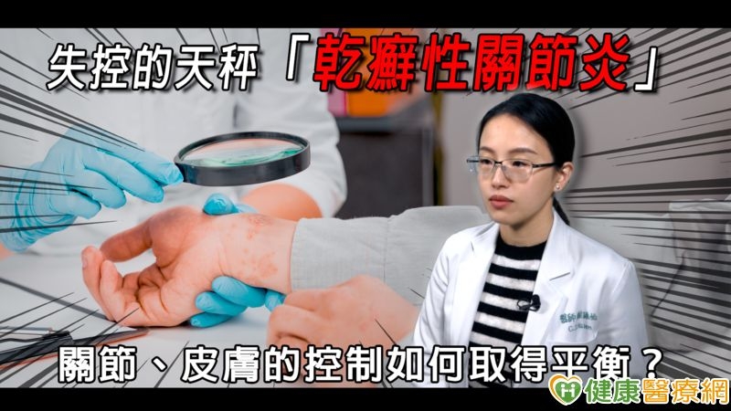 失控的天秤「乾癬性關節炎」 關節、皮膚的控制如何取得平衡?