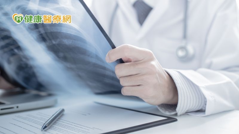 左肺葉出現巨大團塊！　6旬男靠CCRT＋免疫治療提升治癒希望
